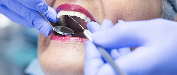 Best Emergency Tooth Extraction in Dumas, TX